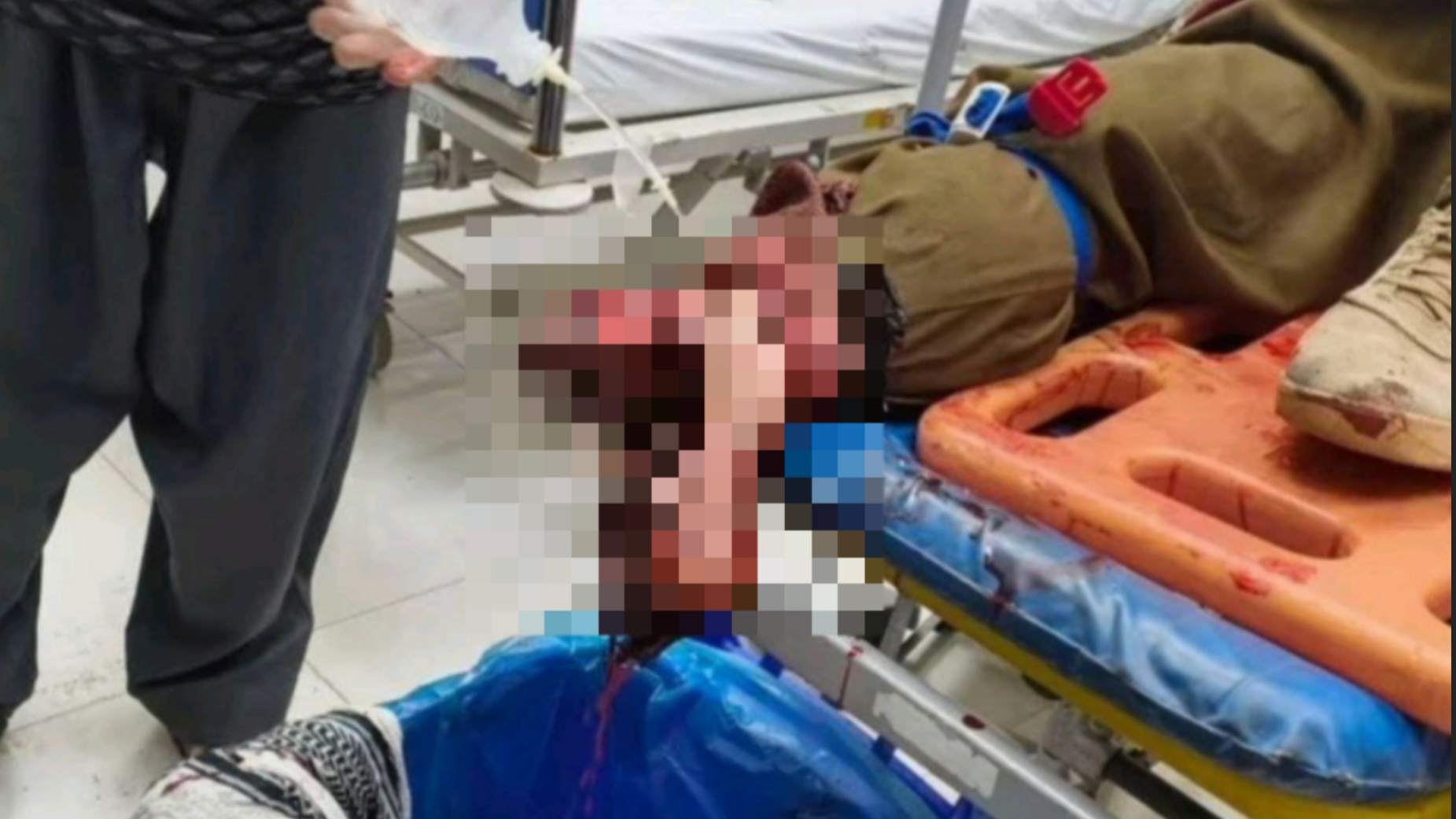 انفجار مین در مرز نوسود؛ مصدومیت شدید کولبر جوانرودی