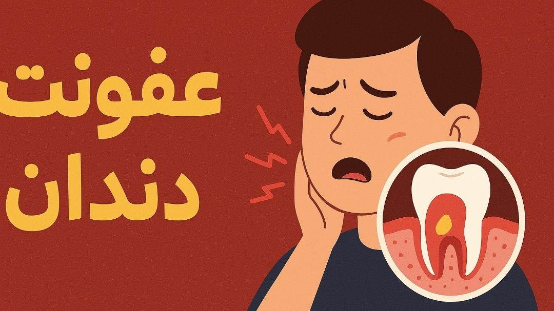 عفونت دندان؛ خطری پنهان اما جدی